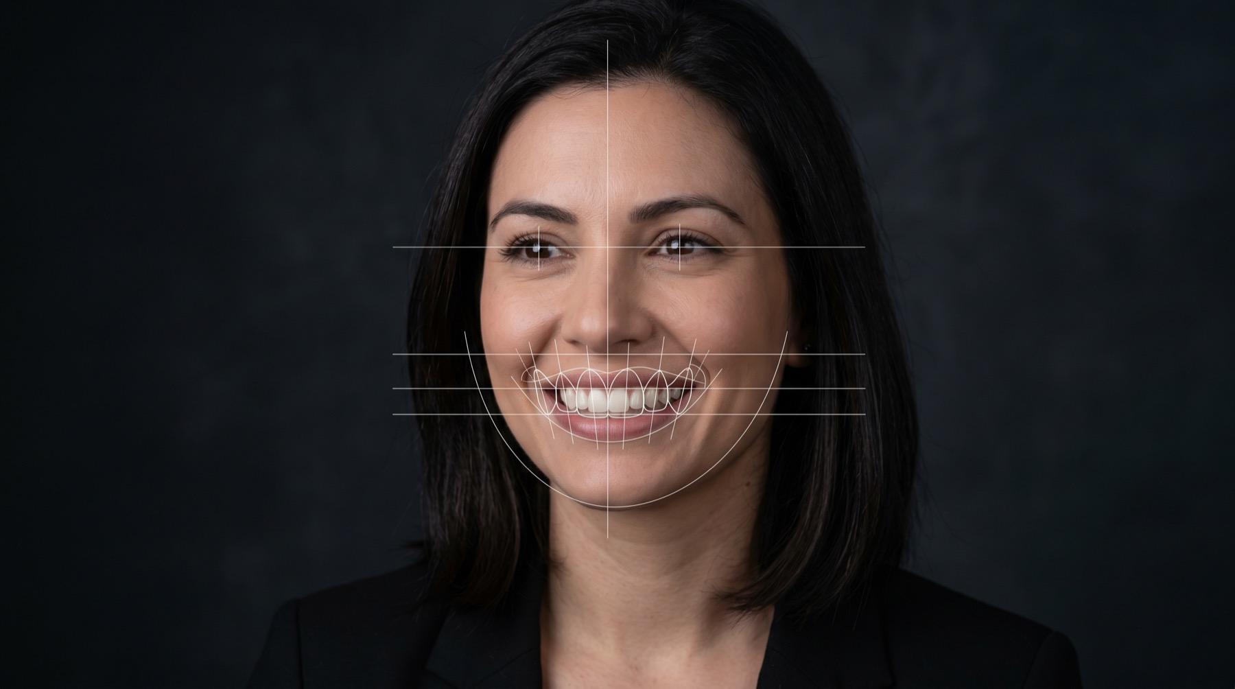 Análisis facial digital para diseño de sonrisa con líneas guía
